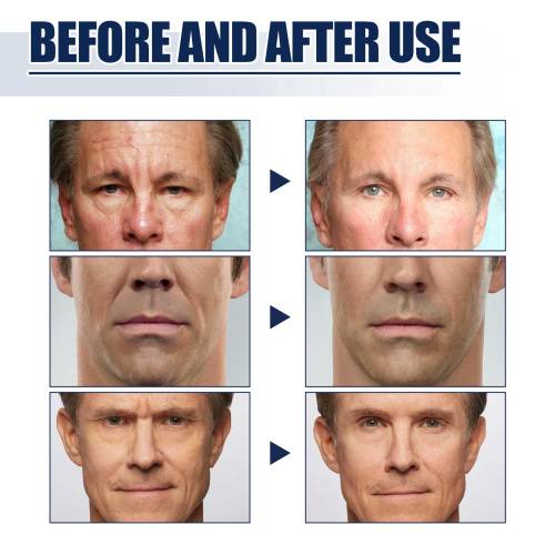East Moon – Kit Raffermissant Visage Homme, Anti-Rides & Lissant