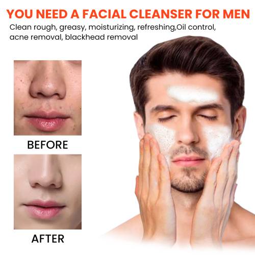 Nettoyant Visage Homme East Moon – Anti-Acné & Anti-Points Noirs